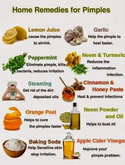 Home remedies for pimples. Bumps On Face, Small Bumps On Face, Remedies For Pimples, Severe Acne Remedies, Natural Remedies For Sunburn, Sunburn Remedies, Home Remedies For Pimples, Home Remedies For Acne, Skin Natural Remedies