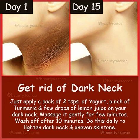 How To Get Rid Of Dark Neck At Home, Remove Neck Darkness, Get Rid Of Dark Neck, Turmeric For Skin, Dark Neck, Skin Care Home Remedies, Natural Face Cleanser, Tips For Happy Life, Skin Face Mask