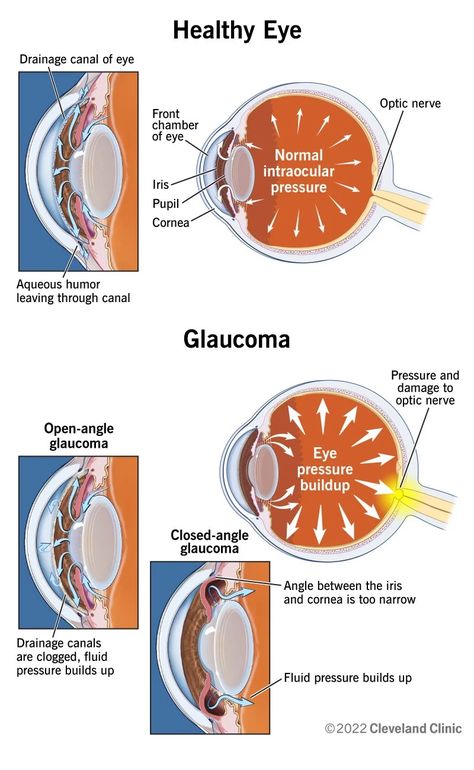 Optometry School Notes, Eye Excercise, Optometry Notes, Ophthalmology Notes, Eye Health Facts, Optometry Education, Optometry School, Forward Head Posture Exercises, Neck And Shoulder Muscles