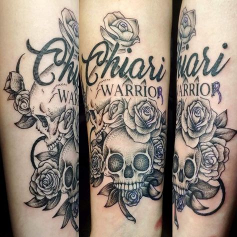 Chiari Tattoo Ideas, Chiari Malformation Tattoos, Chiari Tattoo, Pawprint Tattoo, Chiari Malformation, Tat Ideas, Ink Ideas, First Tattoo, Im In Love