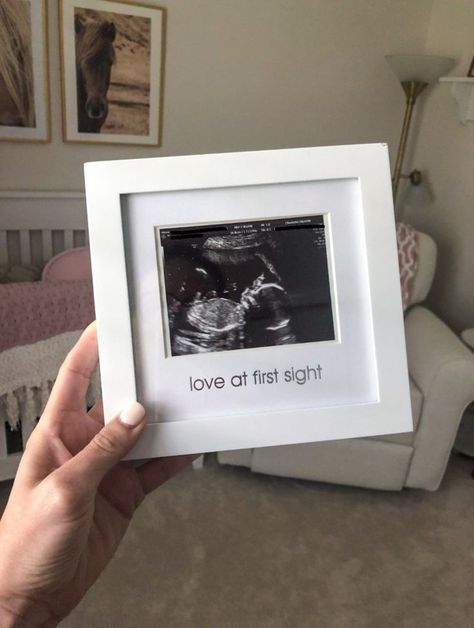 19 Weeks Pregnant, Braxton Hicks, Pregnancy Ultrasound, Baby Picture Frames, Diy Photo Book, Ultrasound Pictures, Baby Scan, Birth Photographer, Gender Reveal Party Decorations