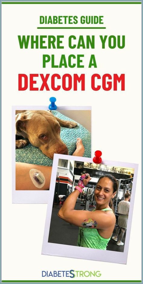 The Healthy Way Is The Right Way. loss your extra fat and ge Dexcom Placement Sites, Dexcom G7 Placement Sites, Dexcom G7, A1c Levels, Dexcom G6, Blood Sugar Diet, Blood Sugar Management, Low Blood Sugar, Study Board