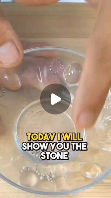 How To Pass A Kidney Stone Fast, Kidney Stone Remedies, Improve Kidney Function, Kidney Stone, Kidney Health, Medical Help, Healthy Choices, Home Remedies, Natural Remedies