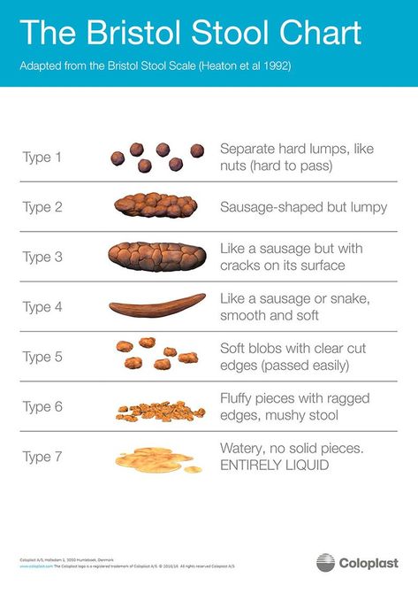 Bowel Movement Chart, Bristol Stool, Stool Chart, Bristol Stool Chart, Practical Paleo, Drinking Warm Lemon Water, Healthy Colon, Bristol University, Bowel Movement