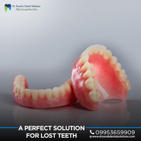 Complete dentures replace your own set of teeth with natural-looking artificial teeth that won't crack, chip or discolour any soon.  Visit Dr Sunali’s Dental Solutions for best consultation on your dental problems. www.drsunalidentalsolutions.com #Dentist #Dental #BestDentisInNoida #dentures Complete Denture Prosthodontics, Complete Denture, Artificial Teeth, Lost Tooth, Dental Problems, Root Canal, Dentures, Dental Clinic, Chips