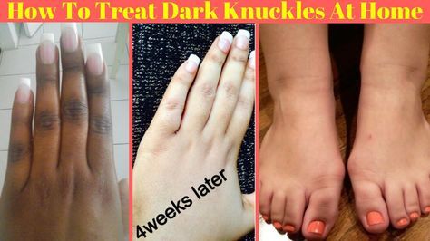 Dark Knuckles, Diy Serum, Skin Care Routine For 20s, Hand And Foot Care, Skin Scrub, Natural Nail Art, Rough Hands, Skin Hand, Perfect Skin Care Routine