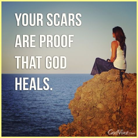 Your Scars are Proof that God Heals - Inspirations Agree Quotes, Sheila Walsh, Christian Woman Encouragement, God Heals, Gods Not Dead, Bible Scripture, Women Of Faith, Bible Encouragement, Christian Inspiration