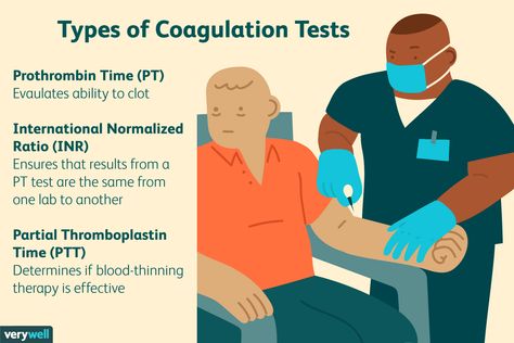 Phlebotomy Study, Prothrombin Time, Medical Laboratory Scientist, Clinical Chemistry, Medical Mnemonics, Certified Medical Assistant, Med Surg Nursing, Nursing School Essential, Lab Values