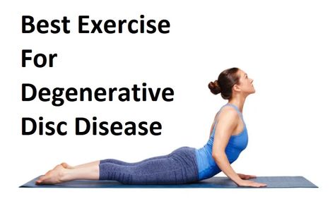 Exercise For Degenrative Disk Disese
Best Exercise For Degenrative Disk Disese
Degenrative Disk Disese Degenerative Disk In Lower Back Exercises, Degenerative Lumbar Disc Disease, Degenerative Disk In Lower Back, Gentle Stretches, Cardiovascular Fitness, Lumbar Disc, Hamstring Muscles, Muscle Stretches, Piriformis Stretch