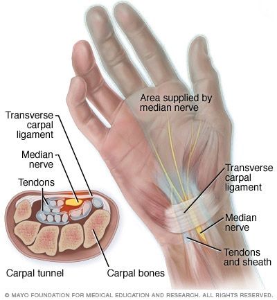 Body Muscle Anatomy, Carpal Tunnel Exercises, Carpal Tunnel Surgery, Carpal Tunnel Relief, Median Nerve, Home Exercise Program, Yoga Anatomy, Musculoskeletal System, Muscle Anatomy