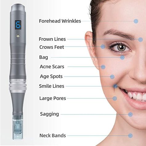 Microneedling Pen, Derma Rolling, Micro Needle Roller, Derma Pen, Scar Removal, Acne Spots, Skin Discoloration, Anti Acne, Anti Aging Skin Products