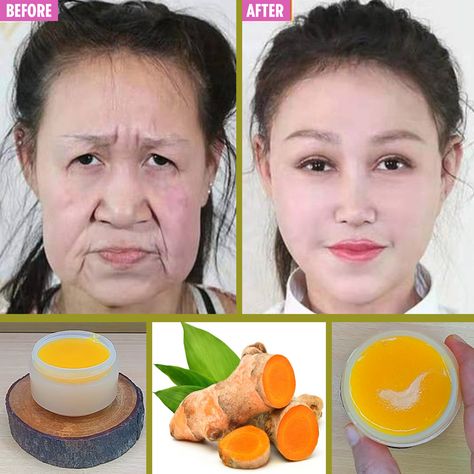 Natural Botox, Face Home, Eliminate Wrinkles, Beauty Diy, Simple Home, Thai Food, Youthful Skin, Wrinkle Remover, Skin Tips