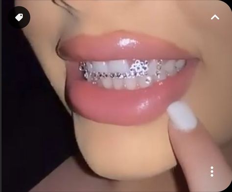 Teeth Jewels, Glossy Aesthetic, Tooth Gems Ideas, Retainer Teeth, Teeth Gems, Pretty Teeth, Grillz Teeth, Pink French Nails, Diamond Teeth