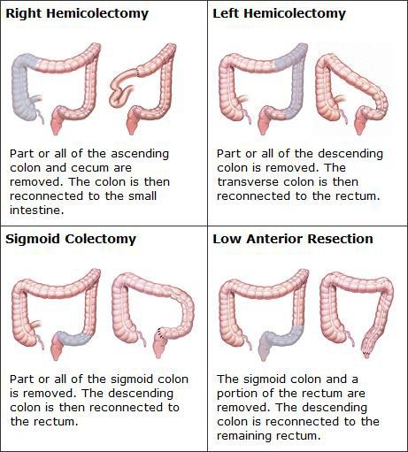 Nursing Terminology, Surgical Assistant, Gastrointestinal Nursing, Surgical Oncology, Wound Care Nursing, Operating Theatre, Nurse Skills, Nursing School Essential, Basic Anatomy And Physiology