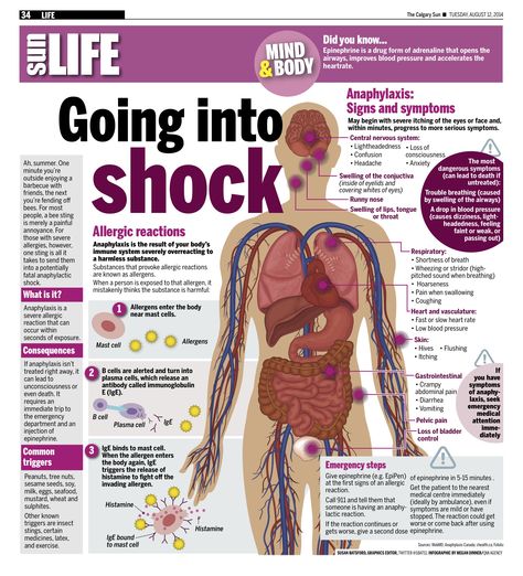 Ah, summer. One minute you’re outside enjoying a barbecue with friends, the next you’re fending off bees. For most people, a bee sting is merely a painful annoyance. For those with severe allergies, however, one sting is all it takes to send them into a potentially fatal anaphylactic shock. Barbecue With Friends, Public Health Nurse, First Aid Tips, Anaphylactic Shock, Emergency Prepardness, Emergency Binder, Medical Facts, Medical School Essentials, Emergency Preparation