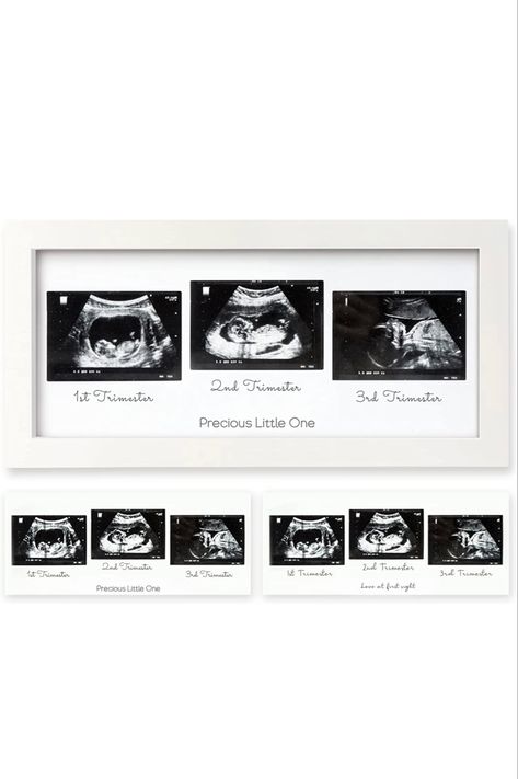 Sonogram picture frame Preserve Ultrasound Pictures, Ideas For Ultrasound Pictures Display, Ultrasound Picture Frame Ideas, Framed Sonogram Pictures, Framed Ultrasound, Sonogram Picture Frame, Ultrasound Frame, Baby Sonogram, Ultrasound Picture Frame