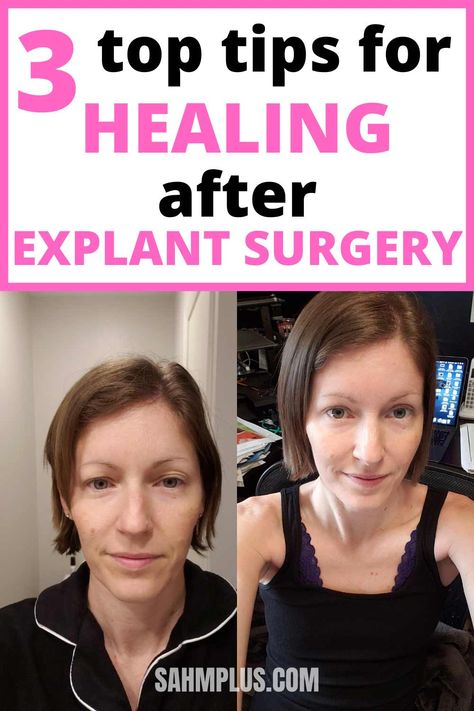 3 recovery tips after explant surgery. Natural healing after surgery Breast Explant Before And After, Natural Laxitive, Healing After Surgery, Explant Surgery, Detox Shakes, Breast Implant Illness, Back To The Gym, Tea Health Benefits, Surgery Recovery