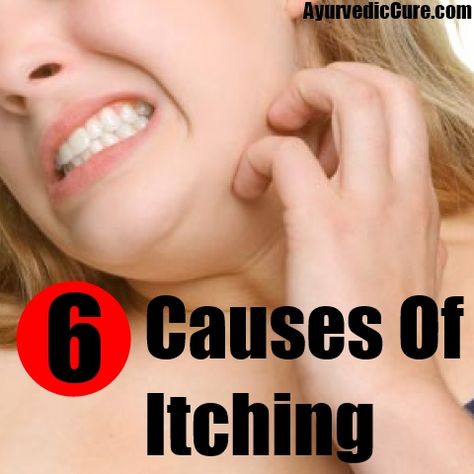 6 causes of itching Itching Remedies, Autogenic Training, Skin Itching, Social Etiquette, Itching Skin, Dry Skin Remedies, Iron Deficiency, Home Remedies For Acne, Alternative Healing