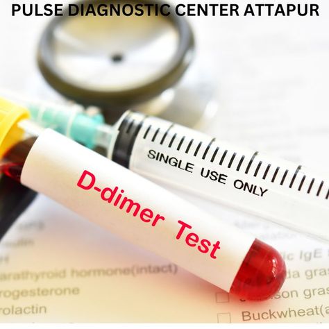 D-dimer tests are performed to look for issues with blood coagulation. Health issues brought on by blood clots include Deep Vein Thrombosis (DVT) and Disseminated Intravascular Coagulation (DIC) If your D-dimer levels are greater than expected, you may have a clotting issue. High D-dimer levels can also result after recent surgery, cardiac illness, and pregnancy. Disseminated Intravascular Coagulation, D Dimer, Vein Thrombosis, Greater Than, Health Issues, Surgery, Health, Quick Saves