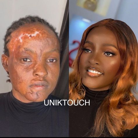 Black Female Excellence on Instagram: “She’s a burn survivor ❤️. Makeup by @uniktouch #blackwomenfeed #blackslayingit . . #blackpeople #blacklove #blackwomen #blackmen #africa…” Black Person, Sfx Makeup, Black Love, Black People, Black Men, Makeup Looks, Black Women, Google Search, Makeup