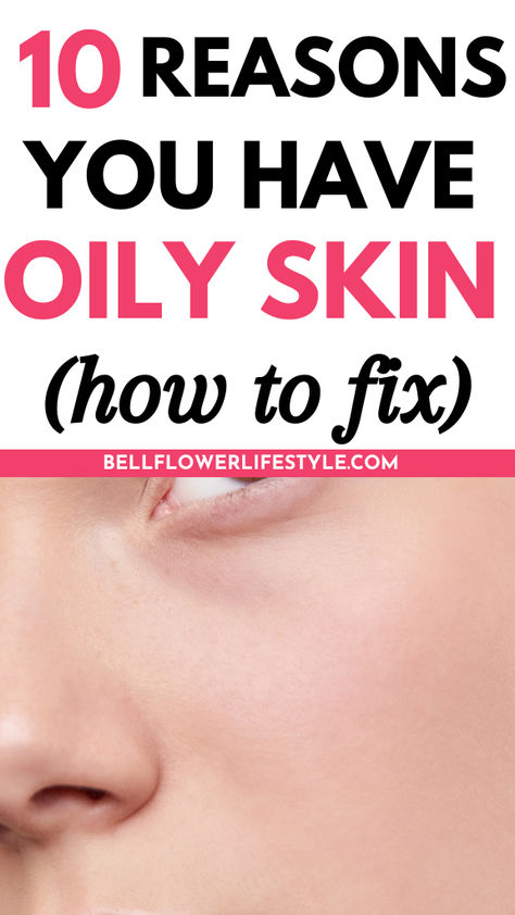 10 reasons you have oily skin ( how to fix ) Why Is My Face So Oily, Skin Care Routine Oily Skin, Oily Skin Tips, Skin Care Oily Skin, Oily Skin Care Tips, Oily Skin Face, Dry Oily Skin, Acne Prone Skin Care, Oily Face