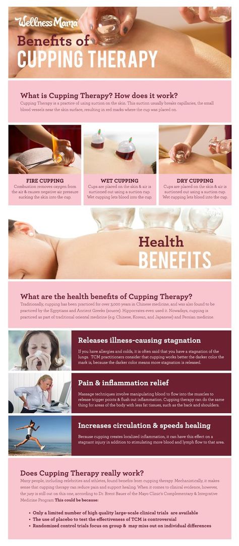 The benefits of cupping therapy- and does it actually work What Is Cupping Therapy, Wet Cupping, Benefits Of Cupping, Fire Cupping, Acupuncture Benefits, Cupping Massage, Wellness Mama, Coconut Health Benefits, Cupping Therapy