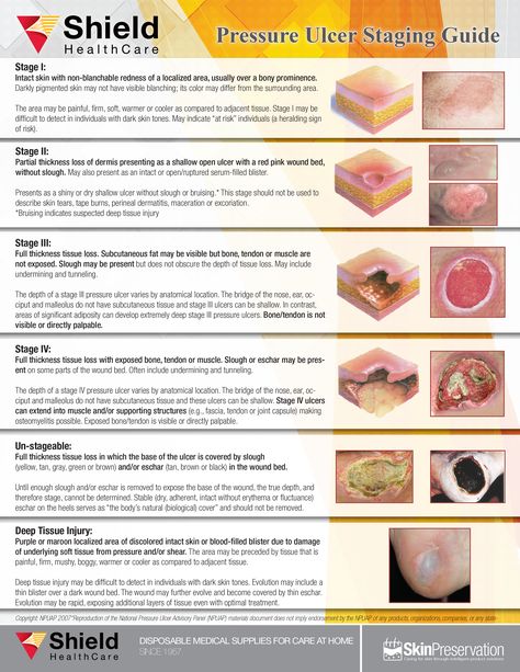 Pressure Wound Stages Wound Nurse, Pressure Ulcer Staging, Pressure Injury, Wound Management, Wound Care Nursing, Home Health Nurse, Nursing Information, Nursing Humor, Nursing Assessment