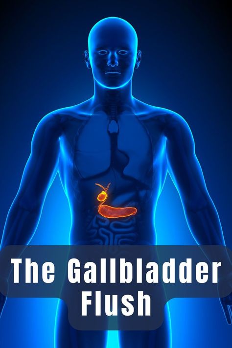 The Gallbladder Flush and Liver Detox Protocol Gallbladder Flush Recipe, Heal Gallbladder, Gallbladder Friendly Recipes, Gallbladder Attack Symptoms, Gallbladder Stones Diet, Gallbladder Symptoms, Liver And Gallbladder Cleanse, Gallstone Diet, Gallbladder Health