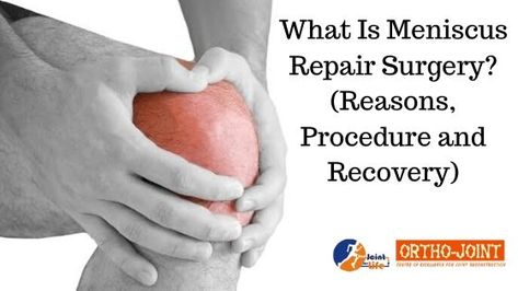 Are you suffering Knee Meniscus Tear? Here we explain about knee meniscus tear reasons, procedure, and recovery from a meniscus tear !!! #OrthoJoint #DrSubhashJangid #KneeReplacementSurgary #OrthoDoctor For More - 👇👇 Knee Meniscus, Surgery, Repair