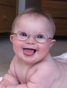 Nice idea but what about the HUMAN factor? | New computer-simulated prescribing strategies for glasses may help Down syndrome patients see better Baby With Glasses, Baby Faces, Life Expectancy, Just Smile, Beautiful Smile, Baby Pictures, Funny Kids, Baby Love