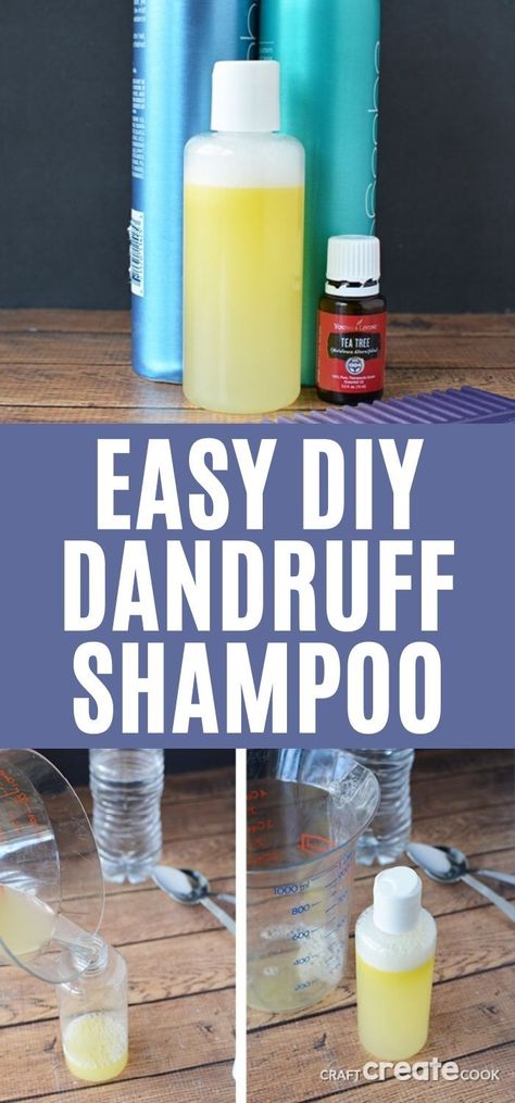 Make this easy Homemade Dandruff Shampoo with Tea Tree Oil and a few simple ingredients to add to your shower routine. A great homeopathic way to eliminate the frustration of itchy scalp! #dandruffshampoo #teatreeoil #diyshampoo #homemadeshampoo Homemade Shampoo For Dandruff, Dandruff Shampoo Diy, Diy Shampoo For Dandruff, Natural Dandruff Shampoo, Homemade Dandruff Shampoo, Tea Tree Oil Shampoo Diy, Diy Tea Tree Shampoo, Diy Dandruff Shampoo, Tea Tree Oil For Dandruff