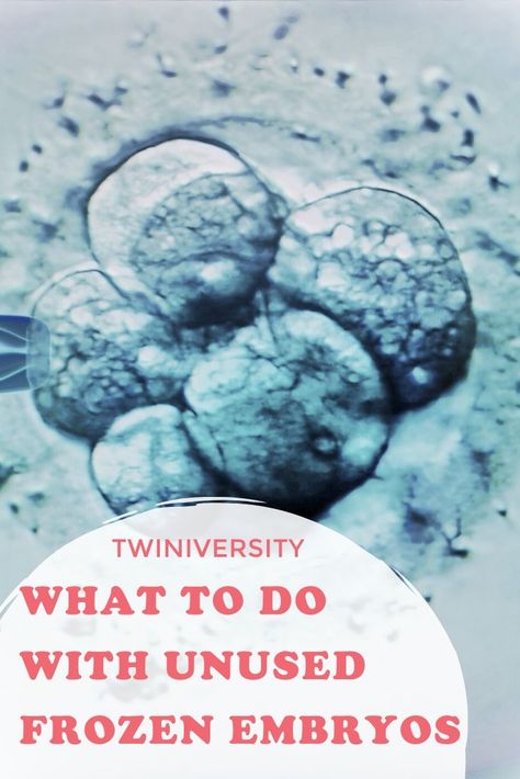 Unused embryos are very common when parents use IVF.  It's only natural that a common question after IVF would be what to do with those embryos when you decide you are done having children.  Learn about the options and what some of our twin parents had to say on the subject! #Twiniversity #Twinmom #Twindad #Twinparents #IVF #Embryos Ivf Twins, Twin Mom, The Subject, Mom And Dad, Twins, Frozen, Parenting