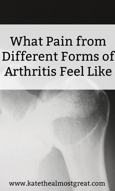 What Does Arthritis Pain Feel Like? Ra Symptoms, Arthritic Pain, Back Pain Remedies, Great Health, Health Life, Hip Pain, Back Pain Relief, Health Lifestyle, Back Pain