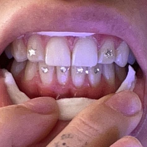 tooth gems Tooth Diamond Teeth Jewelry, Gem Tooth Teeth, Tooth Gems Lower Teeth, Star Tooth Gems Ideas, Tooth Gen Aesthetic, Teeth Gems Men, Butterfly Tooth Gems Ideas, Tooth Gems Aesthetic Simple, Bottom Teeth Gems