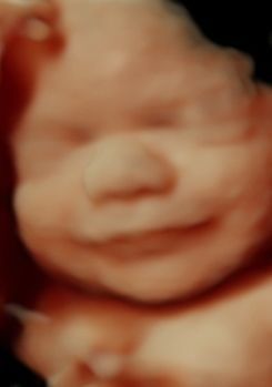 Smile for the camera little one, 3d/4d and HD captures all those precious memories. Gender Determination, 3d Ultrasound, 4d Ultrasound, Pregnancy Ultrasound, All About Mom, Maternity Street Style, Baby Scan, 1st Trimester, Pregnancy Announcement To Husband