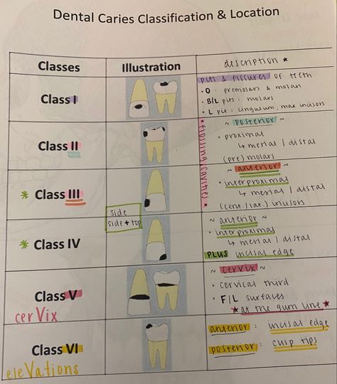 Dental Cements Notes, Dental Burs Names, Dental Assistant Study Notes, Dental Abbreviations, Dental Assistant Study Guide, Dental Notes, Dental Charting, Registered Dental Assistant, Dental Assistant School