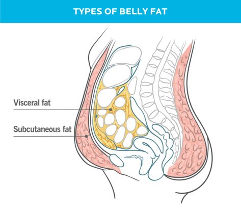 How To Lose Belly Fat, According to Science | Precision Nutrition How To Get Rid Of A Pot Belly, Losing Visceral Fat, Flabby Belly, Belly Fat Reduction, Loose Belly, Precision Nutrition, Tight Tummy, Pot Belly, Remove Belly Fat