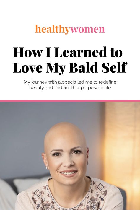 When McKenna’s hair started falling out, she felt like she was losing her identity. As a healthy mother of two children, she thought the sudden hair loss was due to postpartum shedding, but as it got worse, she saw d was diagnosed with #alopecia, an autoimmune disease that affects 7 million people in the U.S. Support from her family and her desire to be strong for her children helped McKenna find empowerment in her diagnosis. Check out her story: https://bit.ly/3rgG8cZ Androgenic Alopecia In Women, Alopecia Universalis, Androgenic Alopecia, Ap Psychology, Bald Patches, Mother Of Two, Purpose In Life, Stimulate Hair Growth, Hair Starting