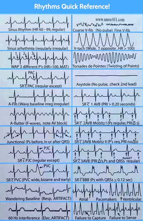 MedicTests.com on Twitter: "https://t.co/Mp5VgxDSog" / Twitter Emt Paramedic Aesthetic, Paramedic Aesthetic, Nurse Knowledge, Paramedic Study, Cardiac Rehab, Emt Study, Er Tech, Psychotropic Medications, Nurse Skills