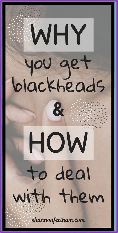 Get Rid of Blackheads For Good Rid Of Blackheads, Black Heads, Word Online, Brittle Nails, School Communication, Creating A Newsletter, Get Rid Of Blackheads, Health Planner, Fitness Advice