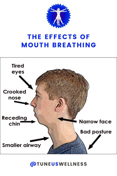 How you breathe has tremendous implications on your overall health and wellbeing.​ Breathing through your nose is so important because it filters the air, humidifies the air, spins the air so it can go deeper into the lower lobes of your lungs. Make sure to be conscious of your breathing and train yourself to breathe through your nose especially at night. Mouth Breather Vs Nose Breather, Nose Breathing, Mouth Breathing, Crooked Nose, Parts Of The Nose, Mouth Breather, Facial Bones, Nose Picking, Shaving Tips