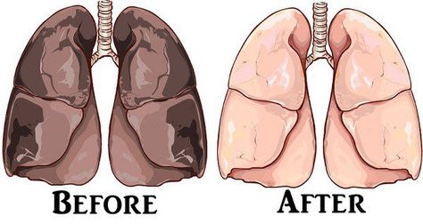 Clean Lungs, Clear Lungs, Lung Cleanse, Lung Detox, Cream Of Tarter, Lungs Health, Liver Detox, Jus D'orange, Cream Of Tartar