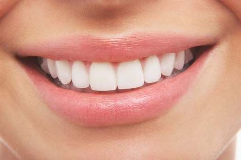 Tooth whitening Midtown is a remarkable option if you desire a brighter smile. However, if you have sensitive teeth, you need to know how the procedure work Pretty Teeth, Dental Images, Sensitive Teeth Remedy, Beautiful Teeth, Teeth Straightening, Perfect Teeth, Natural Teeth Whitening, Natural Teeth, Whitening Kit