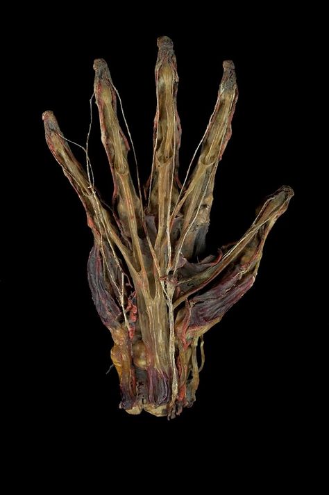 Preserved human left hand, mid 19th century Rotting Flesh Reference, Flower Gore, Decay Aesthetic, Rotting Flesh, Severed Hand, Flesh Art, Vulture Culture, Arte Inspo, Dragon Age