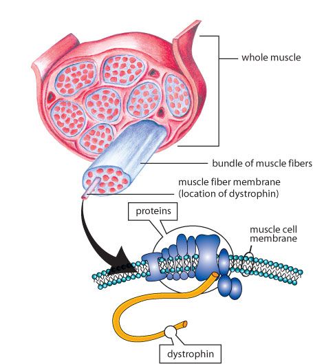 Duchenne Muscular Dystrophy - Dystrphin Gene Mendelian Inheritance, Lumbar Lordosis, Gastrocnemius Muscle, Duchenne Muscular Dystrophy, Muscular Dystrophy, Muscle Protein, Cell Membrane, Calf Muscles, Neurology