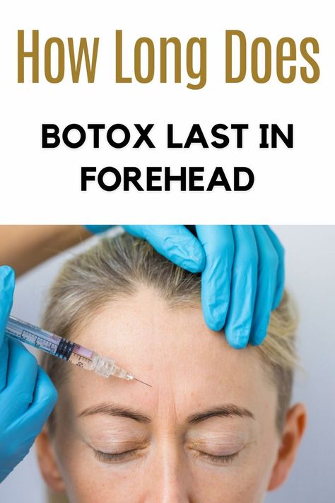 In this article, we will cover all the basics of how long does botox last in forehead. Botox Forehead, Aesthetic Medical, Elegant Headband, Forehead Wrinkles, Grooming Tips, Day Spa, Dermal Fillers, Spa Services, Med Spa