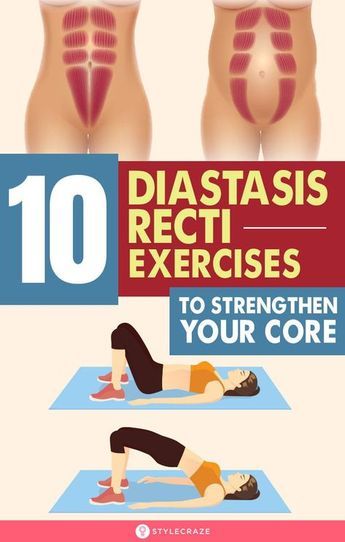 Diastasis Recti Exercise Routine, How To Fix Diastasis Recti Abdominal Muscles, Ab Repair Diastasis Recti, Abdominal Floor Exercises, Abdominal Recti Ab Exercises, Strengthen Deep Core Muscles, Oblique Exercises For Diastasis Recti, Best Exercise For Diastasis Recti, Diastasis Recti Exercises At Home