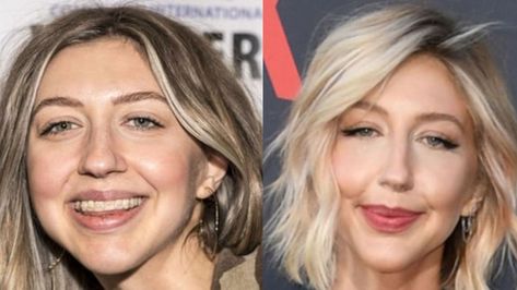 Heidi Gardner’s plastic surgery transformation in her before and after pictures confirms that she has had Botox, fillers, cheek liposuction, and a nose job. Heidi Gardner, Botox Fillers, After Pictures, Nose Job, Before And After Pictures, Plastic Surgery, Surgery