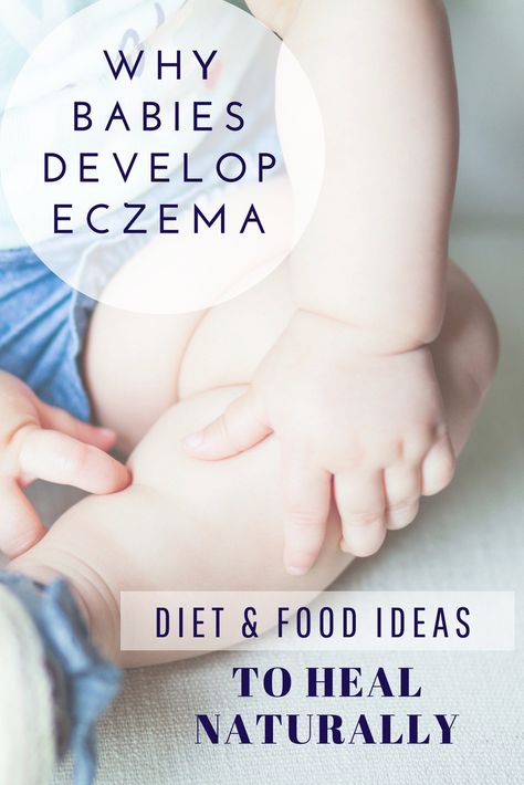 Baby Eczema Causes and Triggers, Diet And Food Recipe Ideas To Heal Naturally (Including for nursing mothers, Infants, and Toddlers ). Learn more about baby eczema and gut connection.  #healthyeating #naturalremedies #eczema #babyfood #baby Lei Lei, Baby Recipes, Home Remedies For Skin, Healthy Baby Food, Baby Foods, Nursing Mother, Mom Hacks, Healthy Babies, Baby Development