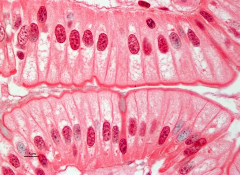 Simple Columnar Epithelium | AnatomyBox Simple Columnar Epithelium, Epithelial Tissue, Clinical Pathology, Anatomy Humor, Tissue Biology, Histology Slides, Under Microscope, Medical Esthetician, Integumentary System